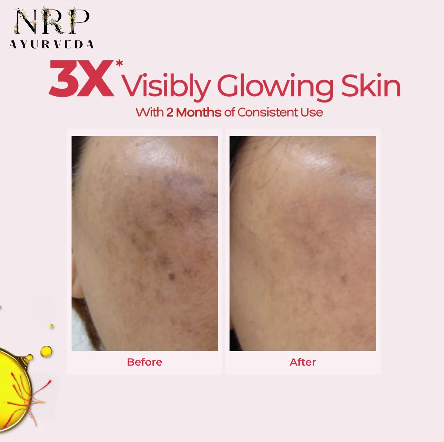 Kumkumadi Tailam (30ml)